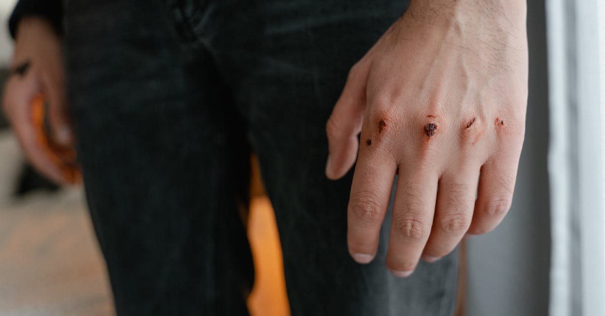 découvrez tout sur les égratignures : causes, traitements et conseils pour les prévenir. que ce soit sur les surfaces, la peau ou vos objets, apprenez à gérer les scratches efficacement.